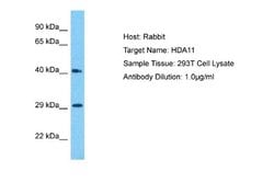 HDAC11 Rabbit anti-Human, Polyclonal, Novus Biologicals 0.1 mL | Buy Online | Novus Biologicals | Fisher Scientific